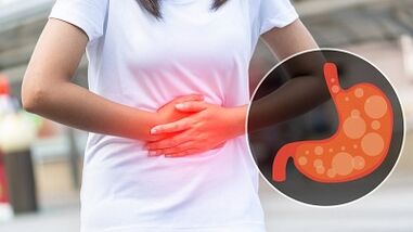 dietary rules for gastritis of the stomach